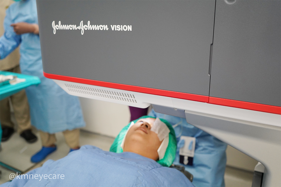 Inilah Revolusi LASIK Non-Flap yang Halus seperti Sutra untuk Penglihatan Jernih Tanpa Kacamata